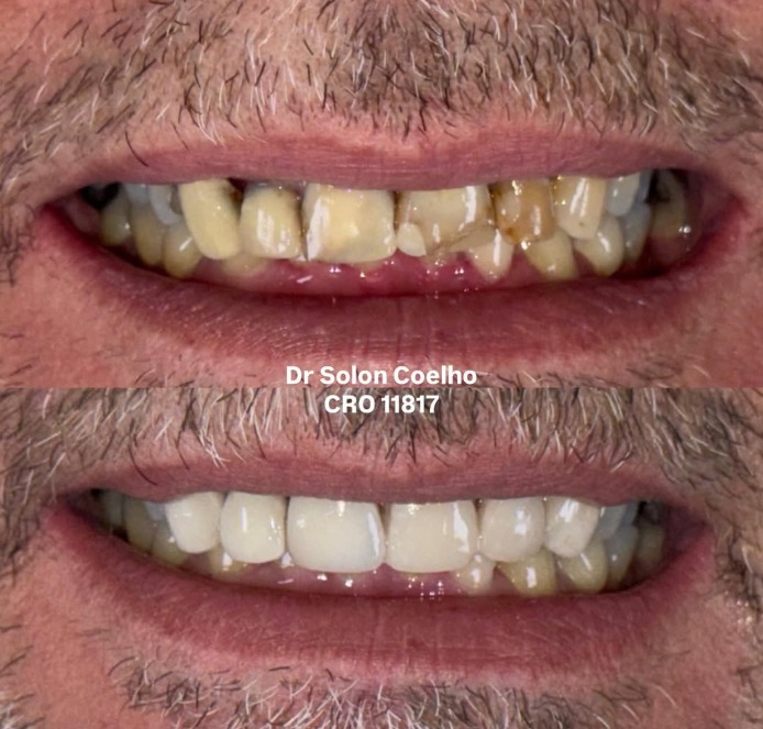 Antes e depois — tratamento estético Dr. Solon Coelho