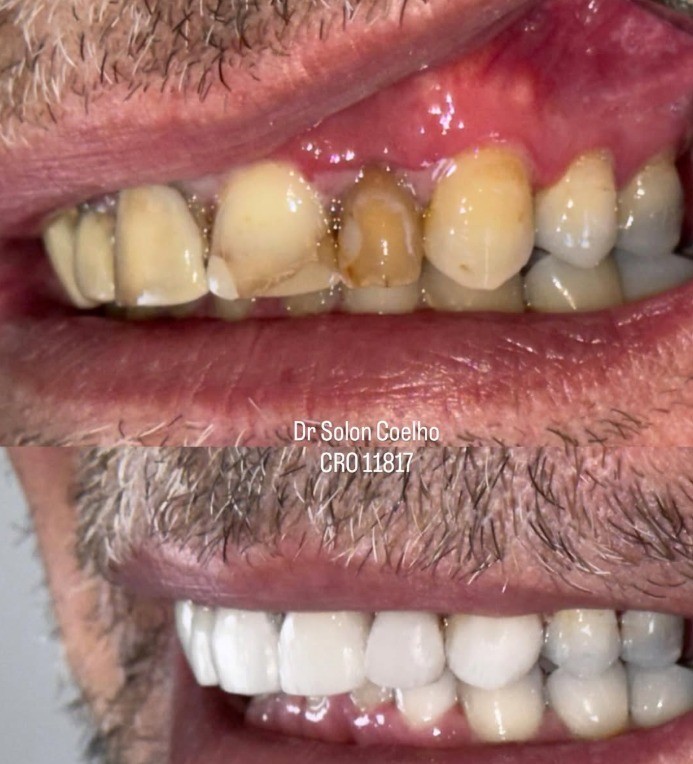 Antes e depois — tratamento estético Dr. Solon Coelho